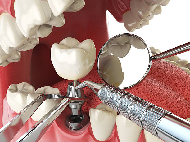Best Emergency Dental Services for Seniors in Jellico, TN